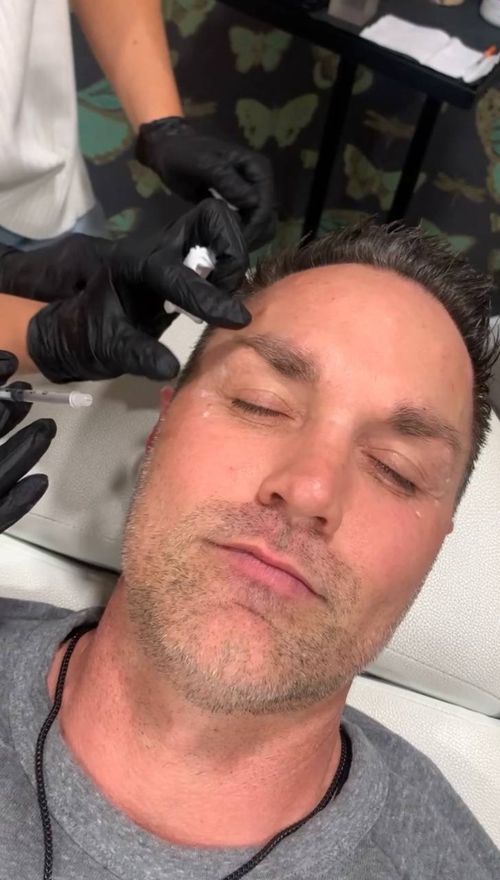 Client receiving Botox at Bleu MedSpa
