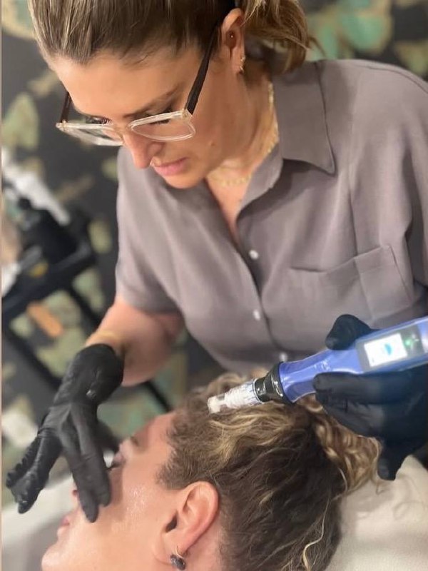 Katie performing skin renewal treatment at Bleu MedSpa